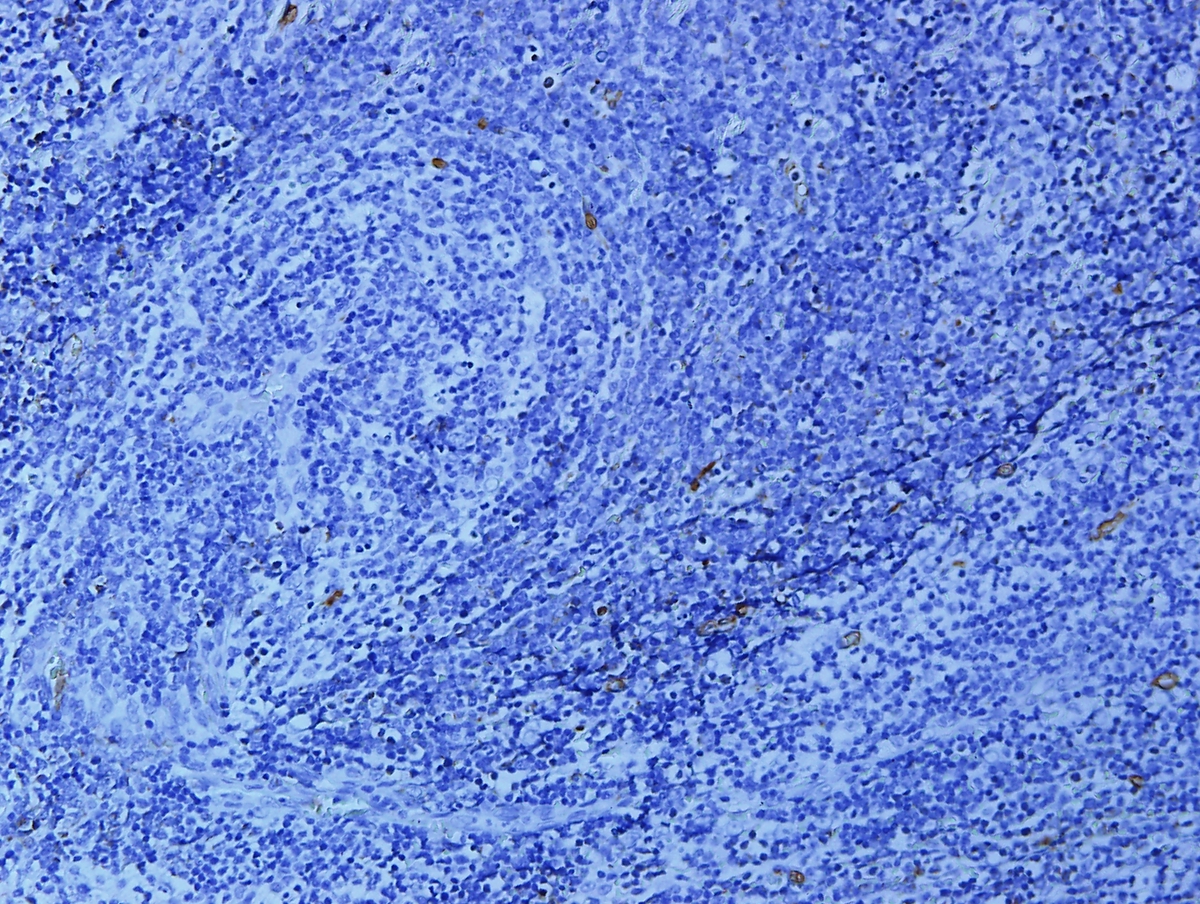 CD34